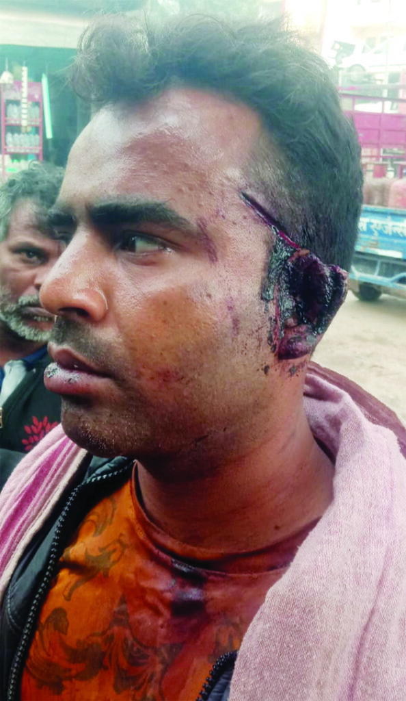 छोटे भाई ने बड़े भाई के ऊपर चाकू से किया जानलेवा हमला